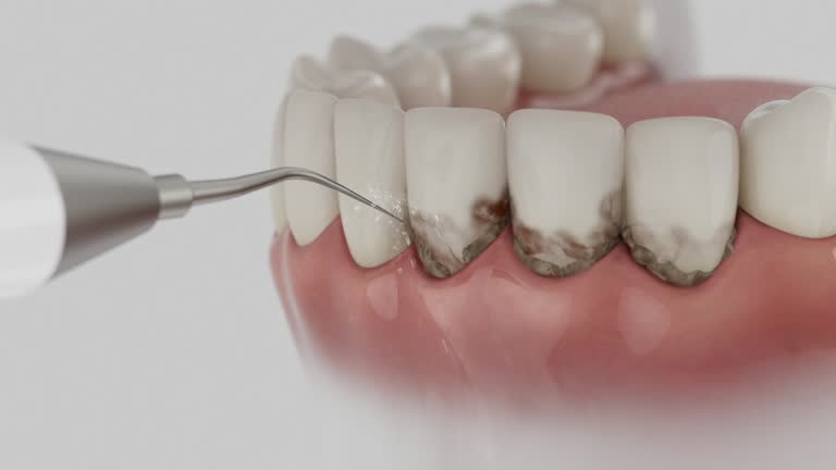 Reliable Dental Implants contractor in Spencer, WI by Smile Center Dentistry